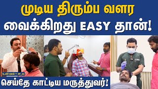 Live hair growth treatment  Hair transplantation explained tamil  Uyirmei EP53 [upl. by Emalee]