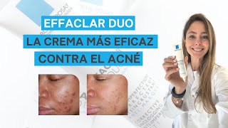 EFFACLAR DUO de La Roche Posay ¿la MEJOR crema para el ACNÉ  Mi opinión después de 8 años [upl. by Vivian]