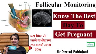 Follicular Study in Hindi  Dr Neeraj Pahaljani [upl. by Alue]