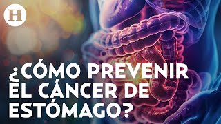 Pérdida de peso inexplicable y dificultad para tragar síntomas del cáncer de esófago y estómago [upl. by Smiga]