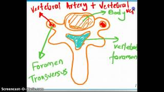 Compression of the vertebral Artery [upl. by Parrnell750]