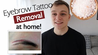 Eyebrow Tattoo Removal at Home How to remove Eyebrow Tattoos safely amp inexpensively [upl. by Arathorn]