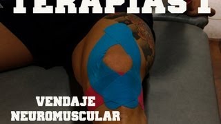 Terapias 1 Vendaje neuromuscular del tendon rotuliano [upl. by Esyahc]