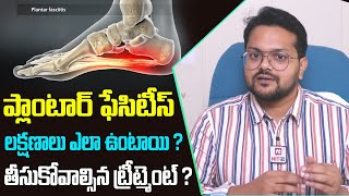 ప్లాంటార్ ఫేసిటీస్ లక్షణాలు ఎలా ఉంటాయి   Causes amp Precautions for Plantar Fasciitis  Hit TV [upl. by Spragens]