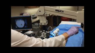 How to Focus and Use a Colposcope [upl. by Idnac]