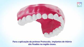 Protocolo Com Carga Imediata  Como Funciona o Protocolo Com Carga Imediata Sorridents Anhangabau [upl. by Olbap470]