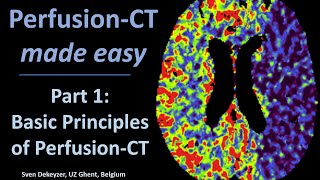 Perfusion CT made easy  part 1  Principles of Perfusion CT [upl. by Llenart]