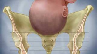 Fetal Descent Birth Station Progress Dilation Effacement Labor Contractions [upl. by Fink208]