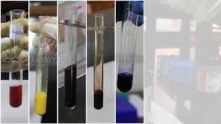 Qualitative Analysis of Amino Acids  Amrita University [upl. by Hsekar]