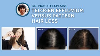 Differences Between Telogen Effluvium and Genetic Pattern Hair Loss [upl. by Belva458]