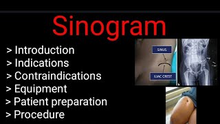 Sinogram  indication  Contraindications procedure Complete study  by BL Kumawat [upl. by Asseralc942]