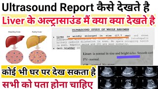 Ultrasound Report कैसे देखते है  Liver ultrasound report  रिपोर्ट मैं क्या क्या देखना होता है [upl. by Addiel]