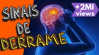 DERRAME CEREBRAL SINAIS e SINTOMAS de um AVC 2022 [upl. by Goraud]