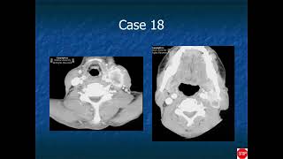 RADIOLOGY EXAM CASES [upl. by Hajar]