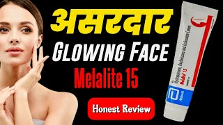 Melalite 15 Cream Review  No Side Effects Skin Whitening Cream  Hydroquinone For Skin Whitening [upl. by Bradney]