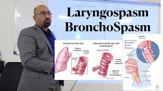 lec LaryngoSpasm amp Bronchospasm [upl. by Ilamad]