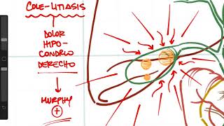 Resumen de la patología de la vía biliar [upl. by Kaasi674]