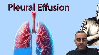 Water on the Lungs Understanding Pleural Effusion Causes and Symptoms [upl. by Ttayw935]