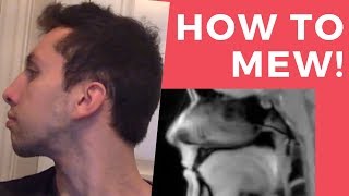 COMPLETE GUIDE on How to Mew Perfect your Tongue Posture [upl. by Luamaj]