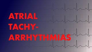 Atrial Arrhythmias Afib vs AFlutter vs Focal vs Multifocal Atrial Tachycardia  MEDZCOOL [upl. by Bertle]