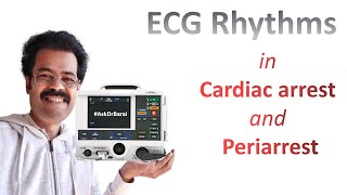 All the ECG Rhythms in Cardiac Arrest and Periarrest scenarios [upl. by Jerrilyn]