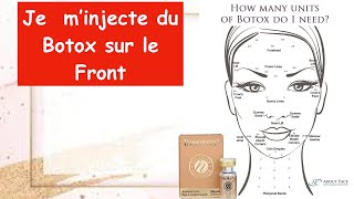 Injection Botox a la maison Eliminer les rides et ridules du Front technique facile et rapide [upl. by Endys]