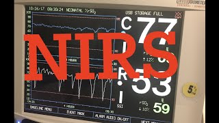 NIRS Near infrared spectroscopy in the ICU [upl. by Egbert991]