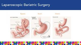 Bellevue Bariatrics Information Seminar [upl. by Leonelle]