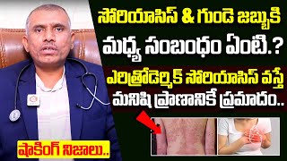 సోరియాసిస్ గుండె జబ్బుకు మధ్య సంబంధమీదే  Connection between Psoriasis and the Heart Problems [upl. by Mchugh]