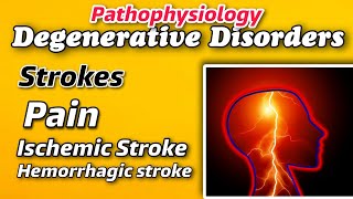 Pathophysiology of DEGENERATIVE DISORDERS  Strokes amp its types  Pain  Expalined by Tutor [upl. by Mihsah578]