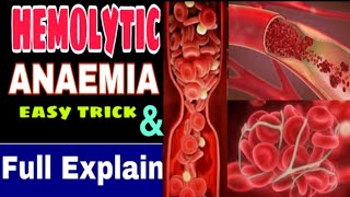 Hemolytic anemia classification  Hemolytic anemia  Hemolytic and Autoimmune anemia symptoms [upl. by Balliett804]