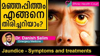 Jaundice  Symptoms and treatments  മഞ്ഞപ്പിത്തം എങ്ങനെ തിരിച്ചറിയാം  Ethnic Health Court [upl. by Vilhelmina]