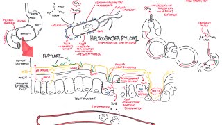 Microbiology  Helicobacter Pylori Ulcer [upl. by Garrik788]