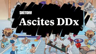 Ascites Diagnosis Causes amp DDx Guide Part 1  Sketchy Medical  USMLE Step 2 CK [upl. by Sibylla]