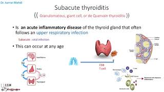 15 Thyroiditis part 2 Subacute [upl. by Zoubek]