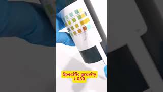 Urinalysis Procedure laboratory mls cls medtechstudent urine urinesediment medtech [upl. by Leighton]