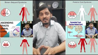 Spinal Cord Injuries  NeuroAnatomy  Rules Facts Clinical Features  Muhammad Kamran Ameer [upl. by Korenblat]