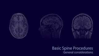 Basic neuroradiology procedures part 1  General considerations [upl. by Lenore]