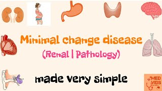 Minimal change disease  Renal system  Pathology  Med vids made simple [upl. by Gustavus855]