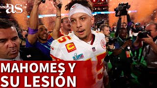 SUPER BOWL  MAHOMES consiguió el anillo LESIONADO  DIARIO AS [upl. by Rodama]