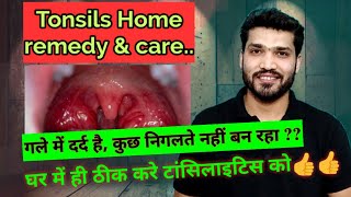 टॉन्सिलाइटिस घरेलू उपचार  Tonsillitis Home Remedies and care [upl. by Server]