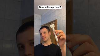 Dermastamp day 7  Dermaroller saç çıkartır mı dermaroller saç minoxidil hair minoxidilresult [upl. by Tnilf]