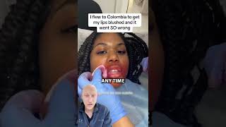 Lip Blushing GONE WRONG  Plastic Surgeon Reacts [upl. by Sug214]