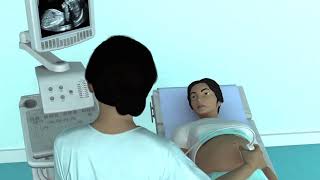 The Basic Steps of an Obstetric Ultrasound Examination [upl. by Scever]