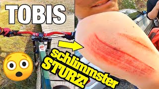 SCHWERER DOWNHILL UNFALL😨ER MUSS INS KRANKENHAUS🚑 [upl. by Darren]