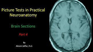 Picture Test in Neuroanatomy Brain Sections 4 [upl. by Anthony]