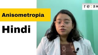 Anisometropia  Anisometropic Amblyopia  Hindi [upl. by Farro831]