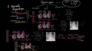 Insuffisance cardiaque aiguë en 3 étapes  Partie 1  Docteur Synapse [upl. by Eidak]