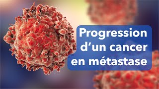 Cancer en progression  mécanisme dune métastase [upl. by Leuams89]