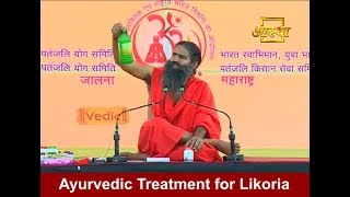 Ayurvedic Treatment for White Discharge लिकोरिया [upl. by Onaicram167]